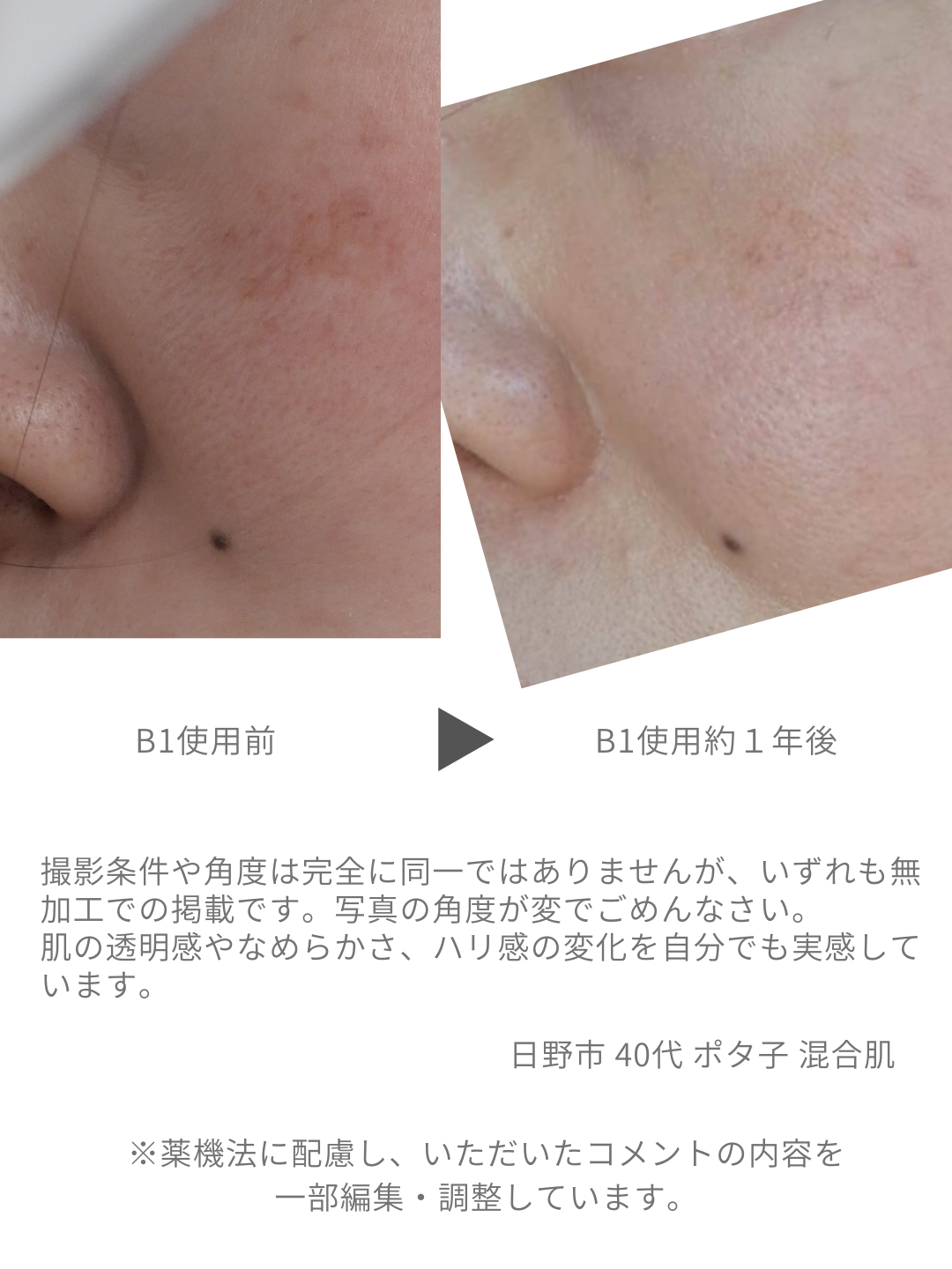 B1化粧水を継続使用した際の肌の質感や印象の変化を比較した無加工写真
